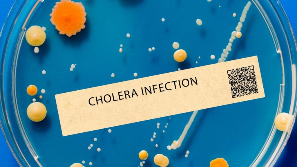 Cas de choléra à La Réunion et à Mayotte : "On est encore loin d'une épidémie", note l'épidémiologiste Renaud Piarroux
Pour le médecin, les deux cas identifiés sur les deux îles sont à "prendre au sérieux". "Il faut mener des actions très rapidement pour éviter que la maladie se transmette autour des patients", conseille-t-il.