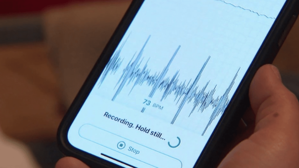 Cardiologie : un dispositif de télémédecine expérimenté dans le Bourbonnais
Dans le Bourbonnais, les habitants doivent parcourir en moyenne entre 50 et 100 kilomètres afin de consulter un cardiologue. Un dispositif intitulé "Cardio+" y est expérimenté. Des infirmières spécialisées effectuent des actes à domicile, et les données sont analysées par un cardiologue en télémédecine.