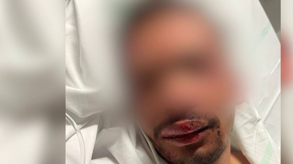 Grande-Synthe : une ville sous tension depuis le meurtre de Philippe
Malgré l'incarcération des deux meurtriers présumés de Philippe Coopman, la ville de Grande-Synthe (Nord) reste traumatisée par le drame ainsi que par l'agression d'un cousin d'un suspect.