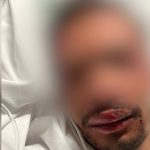 Grande-Synthe : une ville sous tension depuis le meurtre de Philippe
Malgré l'incarcération des deux meurtriers présumés de Philippe Coopman, la ville de Grande-Synthe (Nord) reste traumatisée par le drame ainsi que par l'agression d'un cousin d'un suspect.